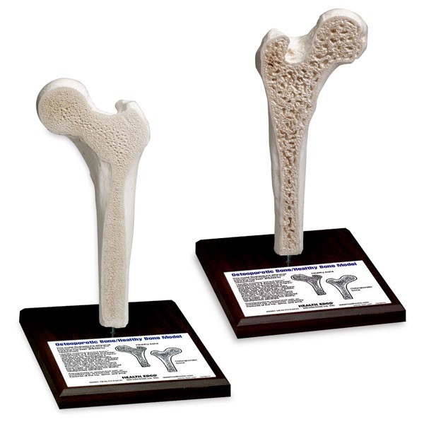 Osteoporosis Model - SB36932G